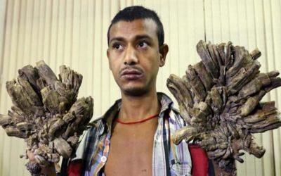 ‘ট্রি-ম্যান’ আবুল বাজনদার (ফাইল ফটো)