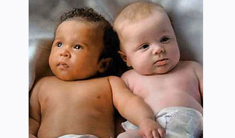 Ella dio a luz mellizos de padres diferentes - Imagen 2