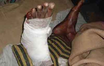 ছাত্রলীগ নেতার হাত-পায়ের রগ কাটলো শিবির