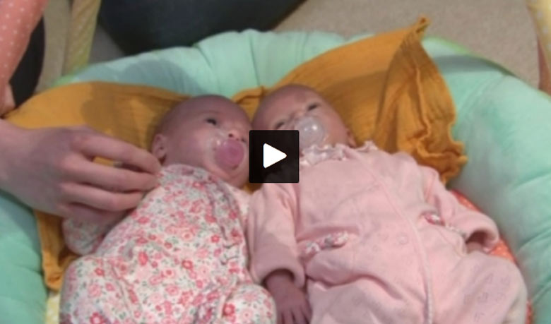 ‘পুরুষ’ জন্ম দিলেন যমজ বাচ্চা