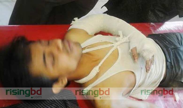 ফেনীতে সাংবাদিকের হাত-পা ভেঙে দিয়েছে সন্ত্রাসীরা