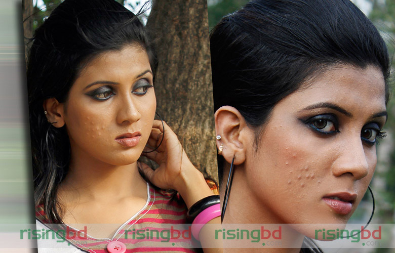 ব্রণ থেকে মুক্ত থাকার উপায়