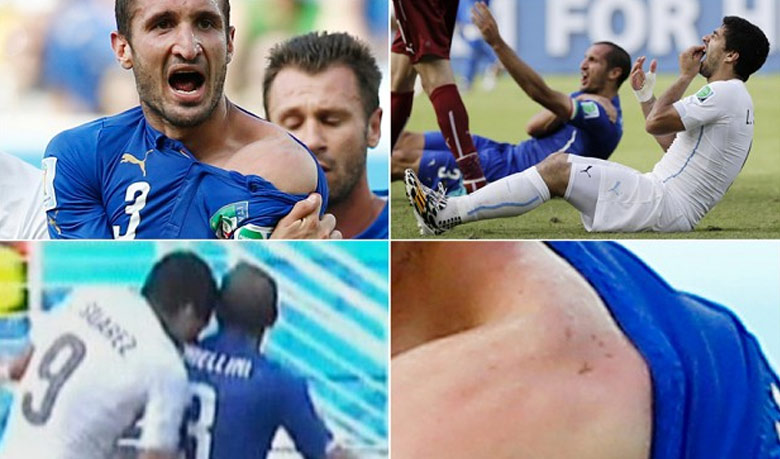`Suarez bite was like kiss from girlfriend`