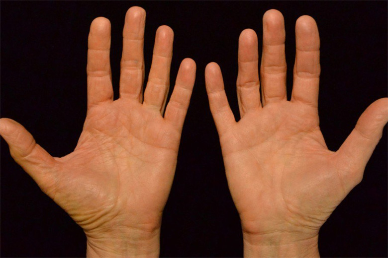 হাত থেকেই জেনে নিন আপনি কতটা সুস্থ