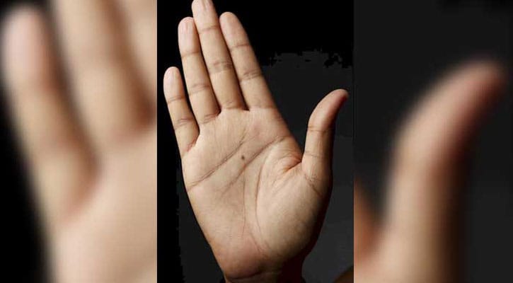 হাতের তালুতে তিল থাকা শুভ নাকি অশুভ? হাতের তালুতে তিল থাকা শুভ নাকি অশুভ?