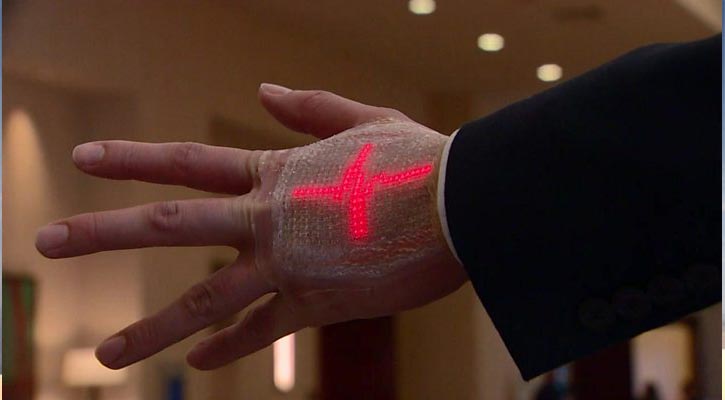 Wearable tech aids stroke patients