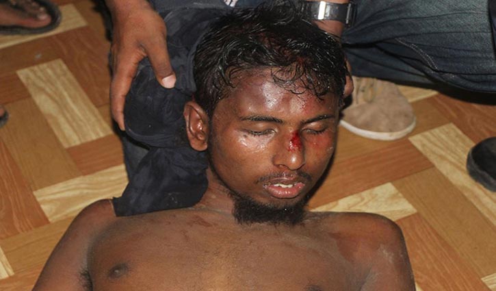 Zafar Iqbal stabbed: Attacker was alone