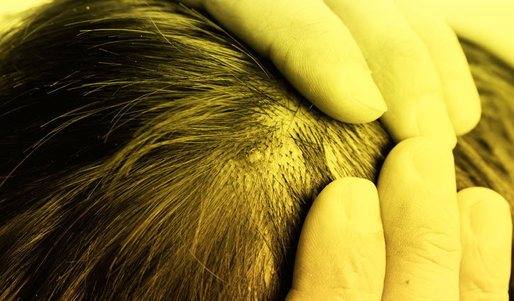 Best ways to protect against skin cancer