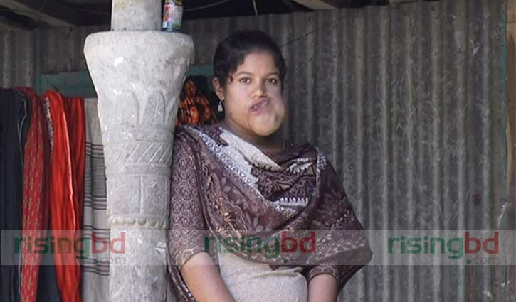 চিকিৎসার জন্য ঢাকা যাচ্ছে তমা