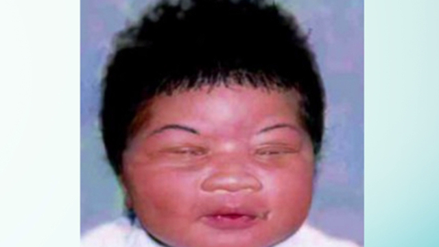 Baby who was abducted from hospital found 18 yrs later