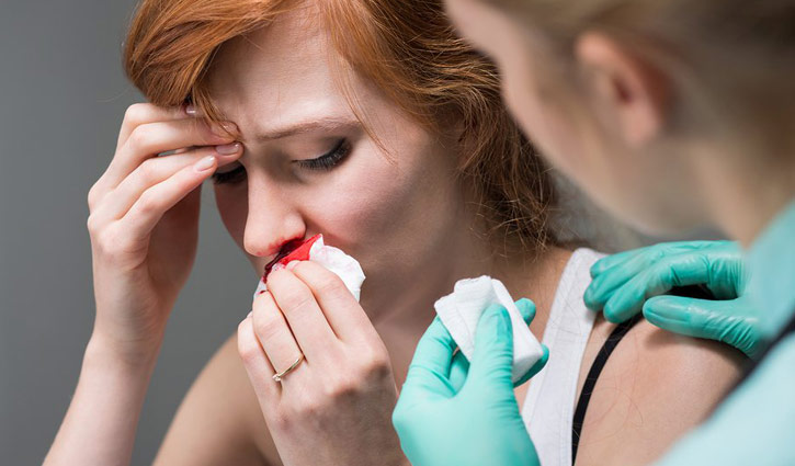 নাক থেকে রক্ত পড়ার ৬ কারণ