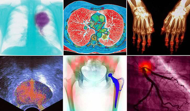 মানুষের সবচেয়ে ভয়ানক রোগের ছবি