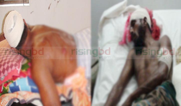 20 injured in separate clashes in Gopalganj