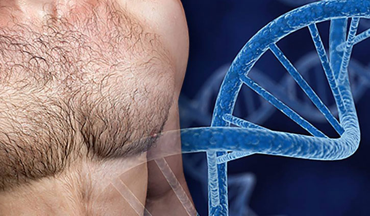 পুরুষের স্তন ক্যানসারের লক্ষণ ও চিকিৎসা