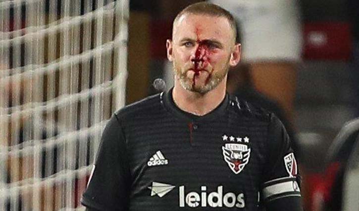 Rooney breaks nose, DC United duck with first MLS goal