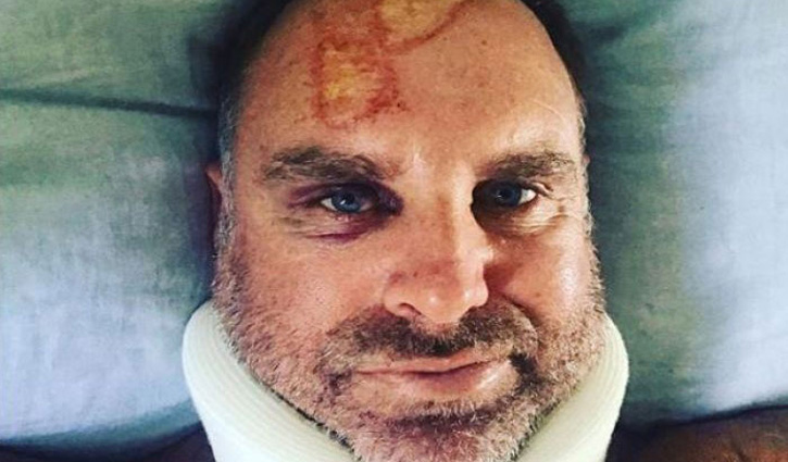 Hayden narrowly escapes surfing accident