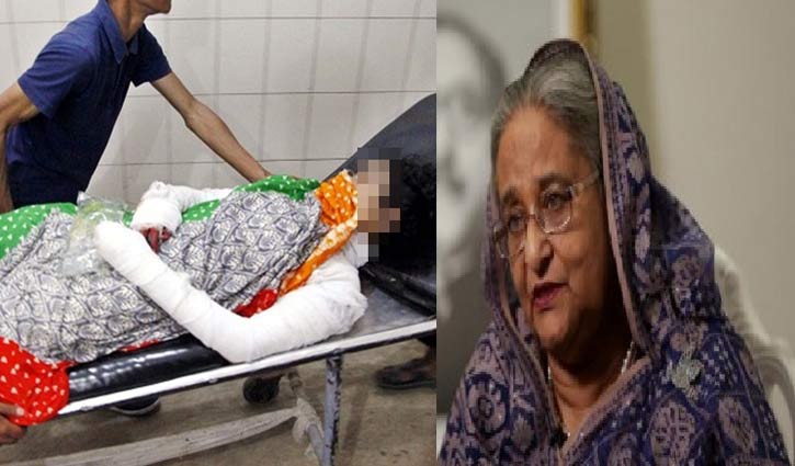 PM directs to take Feni female madrasa student to Singapore