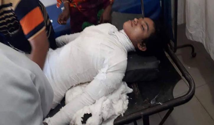 Feni female Madrasa student battling for life