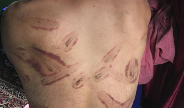 বৈদ্যুতিক শক দিয়ে জ্ঞান ফিরিয়ে আবার পেটানো হতো কাশ্মীরীদের