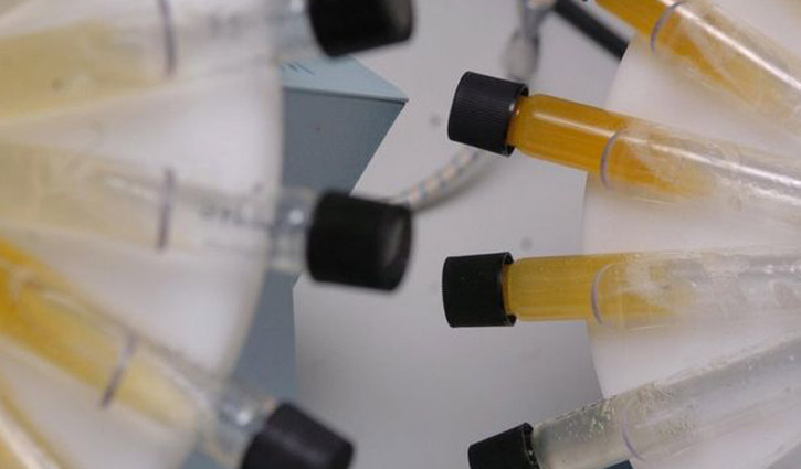 প্রস্রাবের কারণে সিনেমা হল বন্ধ