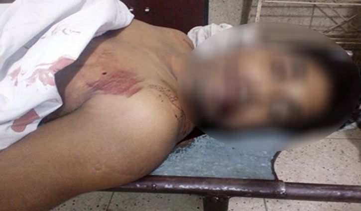 লিফটে চাপা পড়ে মারা গেলেন ফারুক লিফটে চাপা পড়ে মারা গেলেন ফারুক