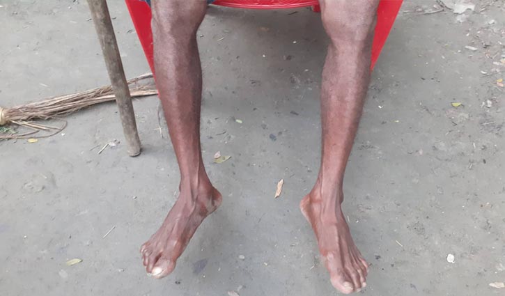 পা নয় যেন পাটকাঠি পা নয় যেন পাটকাঠি