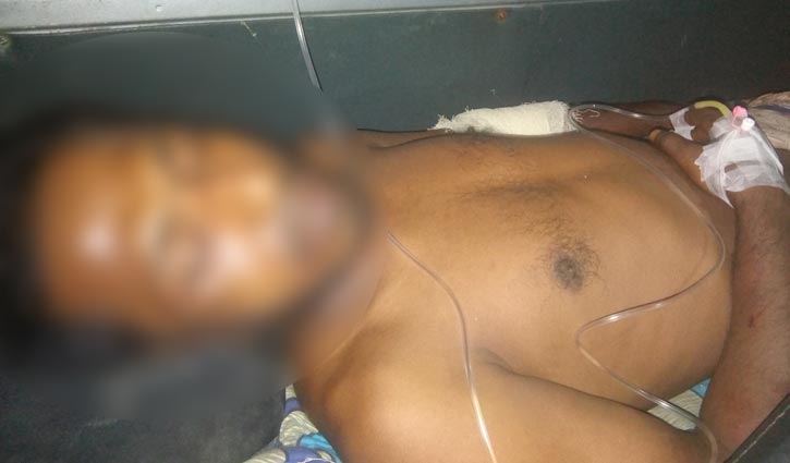 গণধর্ষণের মামলার বাদীর দুই পা গুঁড়িয়ে দিয়েছে আসামিরা গণধর্ষণের মামলার বাদীর দুই পা গুঁড়িয়ে দিয়েছে আসামিরা
