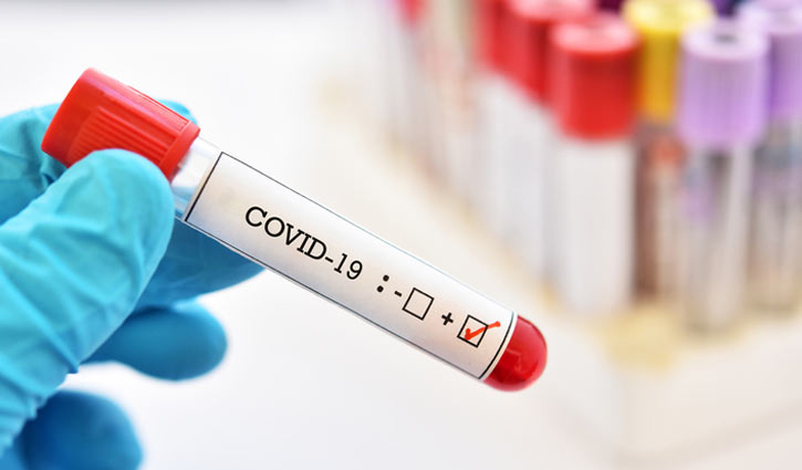 OC among 13 test coronavirus positive in Habiganj