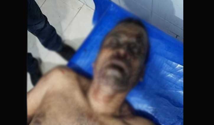 শৈলকুপায় নির্বাচনি সংঘর্ষে নিহত ১ শৈলকুপায় নির্বাচনি সংঘর্ষে নিহত ১