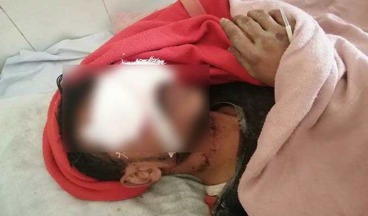 চুরির অপরাধে দু’চোখ উপড়ে ফেলার চেষ্টা চুরির অপরাধে দু’চোখ উপড়ে ফেলার চেষ্টা