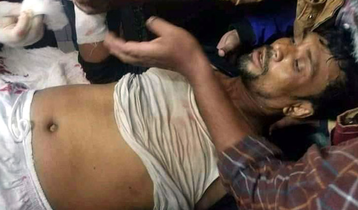 বরগুনায় অস্ত্রের কোপে ইউপি চেয়ারম্যানের পায়ের হাড় বিচ্ছিন্ন বরগুনায় অস্ত্রের কোপে ইউপি চেয়ারম্যানের পায়ের হাড় বিচ্ছিন্ন