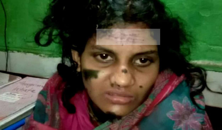 ভাতিজিকে পিটিয়ে-ব্লেড দিয়ে চিরে রক্তাক্ত করলেন চাচা ভাতিজিকে পিটিয়ে-ব্লেড দিয়ে চিরে রক্তাক্ত করলেন চাচা