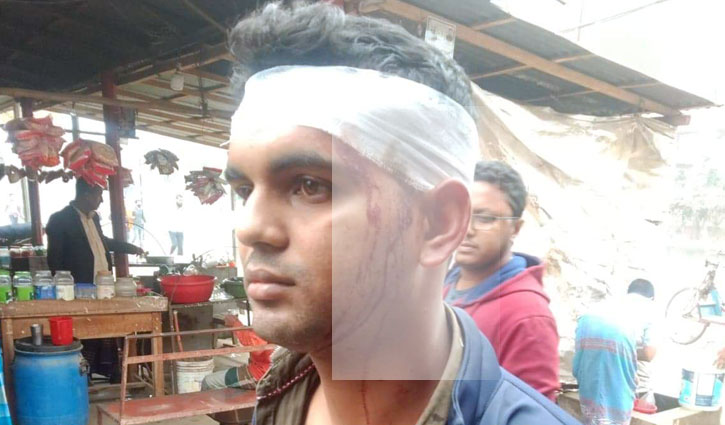 ময়মনসিংহে গ্রামীণফোন কর্মীকে হাতুড়িপেটা ময়মনসিংহে গ্রামীণফোন কর্মীকে হাতুড়িপেটা