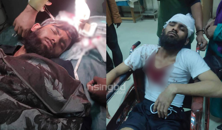 চাঁদা না পেয়ে ৩ জনকে কোপানোর অভিযোগে ছাত্রলীগ নেতার বিরুদ্ধে মামলা চাঁদা না পেয়ে ৩ জনকে কোপানোর অভিযোগে ছাত্রলীগ নেতার বিরুদ্ধে মামলা