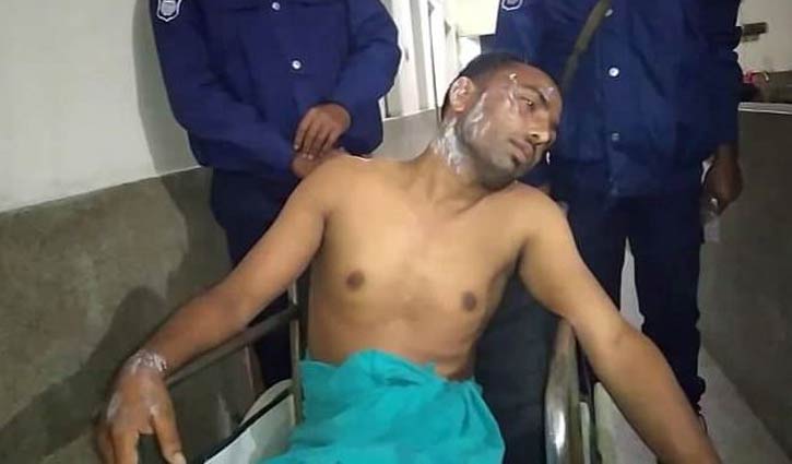 সাবেক স্ত্রীর মুখে এসিড নিক্ষেপ, স্বামী আটক সাবেক স্ত্রীর মুখে এসিড নিক্ষেপ, স্বামী আটক