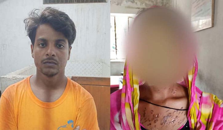 স্ত্রীকে সিগারেটের ছ্যাঁকা দিয়ে নির্যাতনের অভিযোগ স্ত্রীকে সিগারেটের ছ্যাঁকা দিয়ে নির্যাতনের অভিযোগ