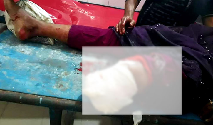 ভোলায় লঞ্চের ধাক্কায় পা হারালেন নারী ভোলায় লঞ্চের ধাক্কায় পা হারালেন নারী