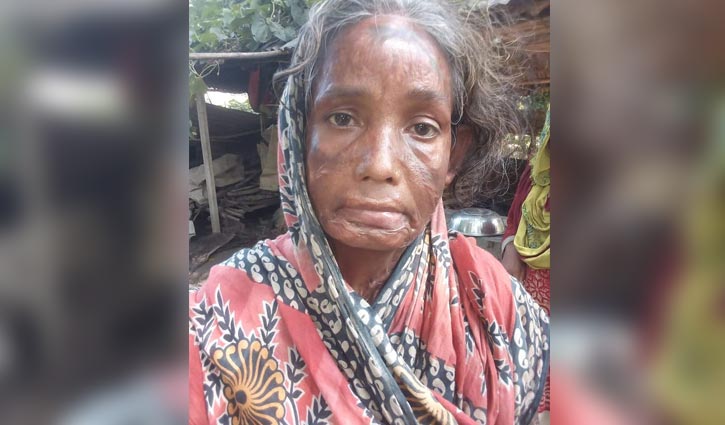 মা জাহেদার জন্য সাহায্যের আবেদন মা জাহেদার জন্য সাহায্যের আবেদন