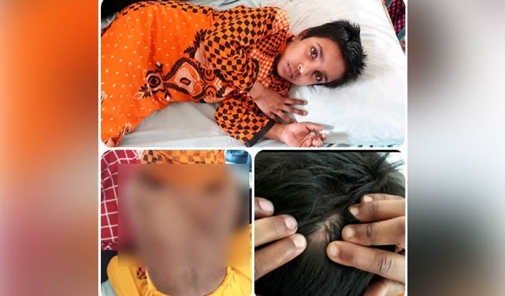 গৃহকত্রীর নির্মম নির্যাতনের শিকার শিশু চাঁদনী, হাসপাতালে ভর্তি গৃহকত্রীর নির্মম নির্যাতনের শিকার শিশু চাঁদনী, হাসপাতালে ভর্তি