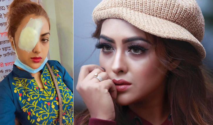 ‘চারদিন পরও ভালোভাবে চোখে দেখছি না’ ‘চারদিন পরও ভালোভাবে চোখে দেখছি না’