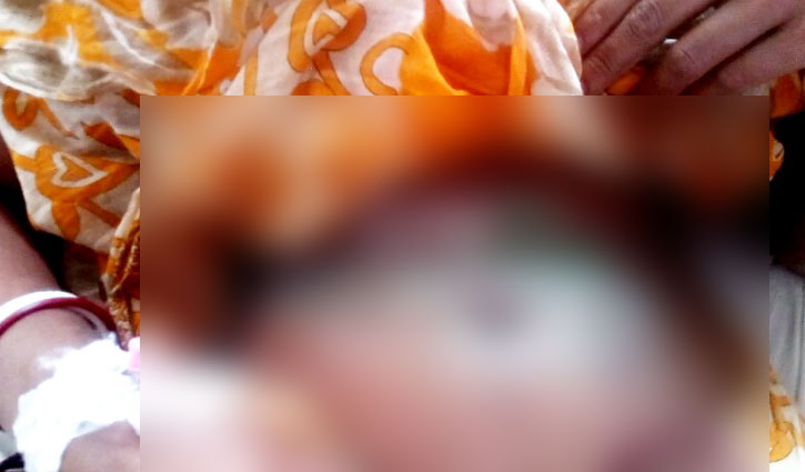 ফুটন্ত পানি গৃহবধূর শরীরে ঢেলে দিলেন শাশুড়ি ফুটন্ত পানি গৃহবধূর শরীরে ঢেলে দিলেন শাশুড়ি