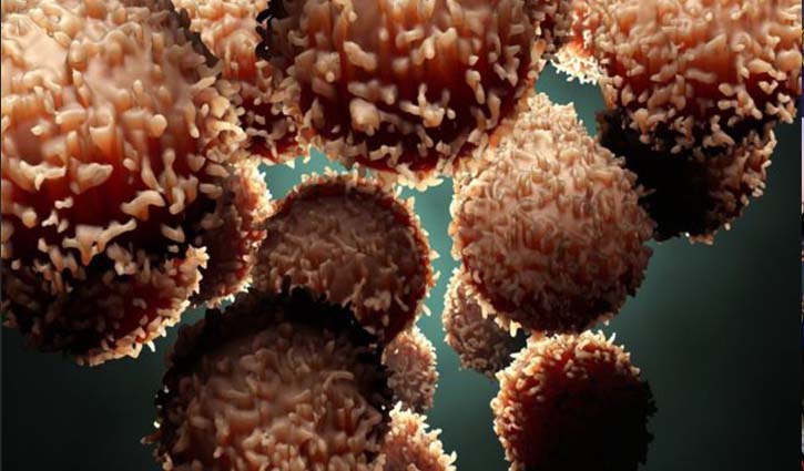 Landmark study to transform cancer treatment