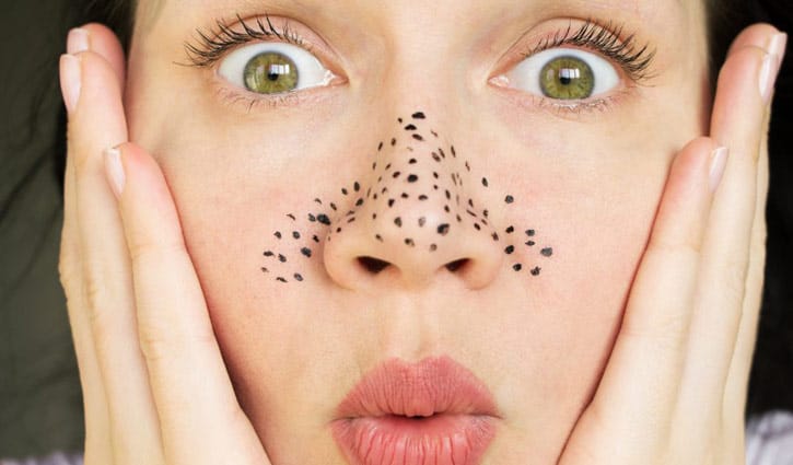 ত্বকের ময়লা দূর করার সহজ উপায়