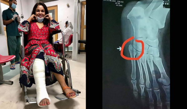 শাওনের পায়ের আঙুলে চিড় ধরেছে