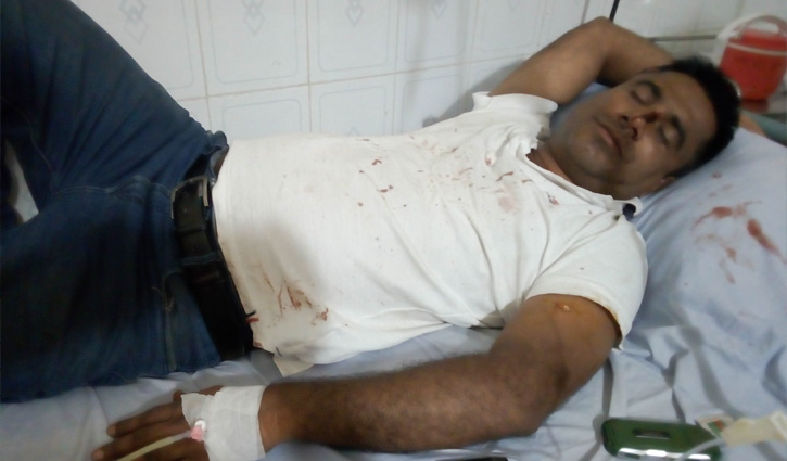 হিলিতে সন্ত্রাসী হামলায় সিনিয়র সাংবাদিক আহত হিলিতে সন্ত্রাসী হামলায় সিনিয়র সাংবাদিক আহত
