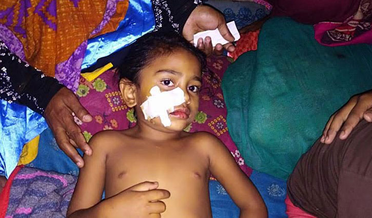 Child seriously injured as hungry dog attacks for bread