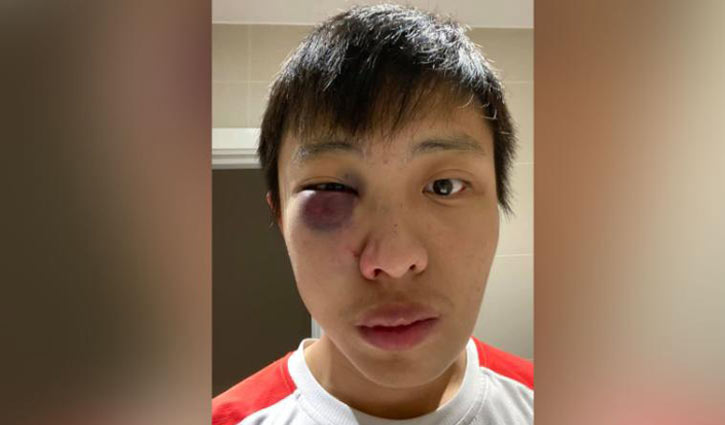 করোনাভাইরাসে আক্রান্ত সন্দেহে পিটুনি