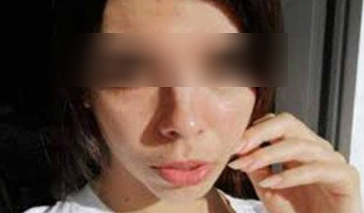 চোখে ট্যাটু করাতে গিয়ে অন্ধ হলেন মডেল