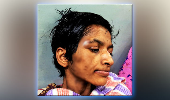 থেঁতলানো শরীর নিয়ে কাতরাচ্ছে ফারজানা