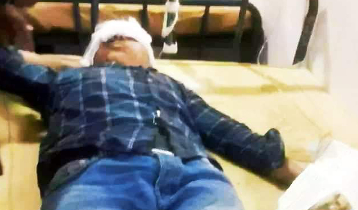 গ্যাস সিলিন্ডার বিস্ফোরণ : চোখ হারালো শিশু নাহিম